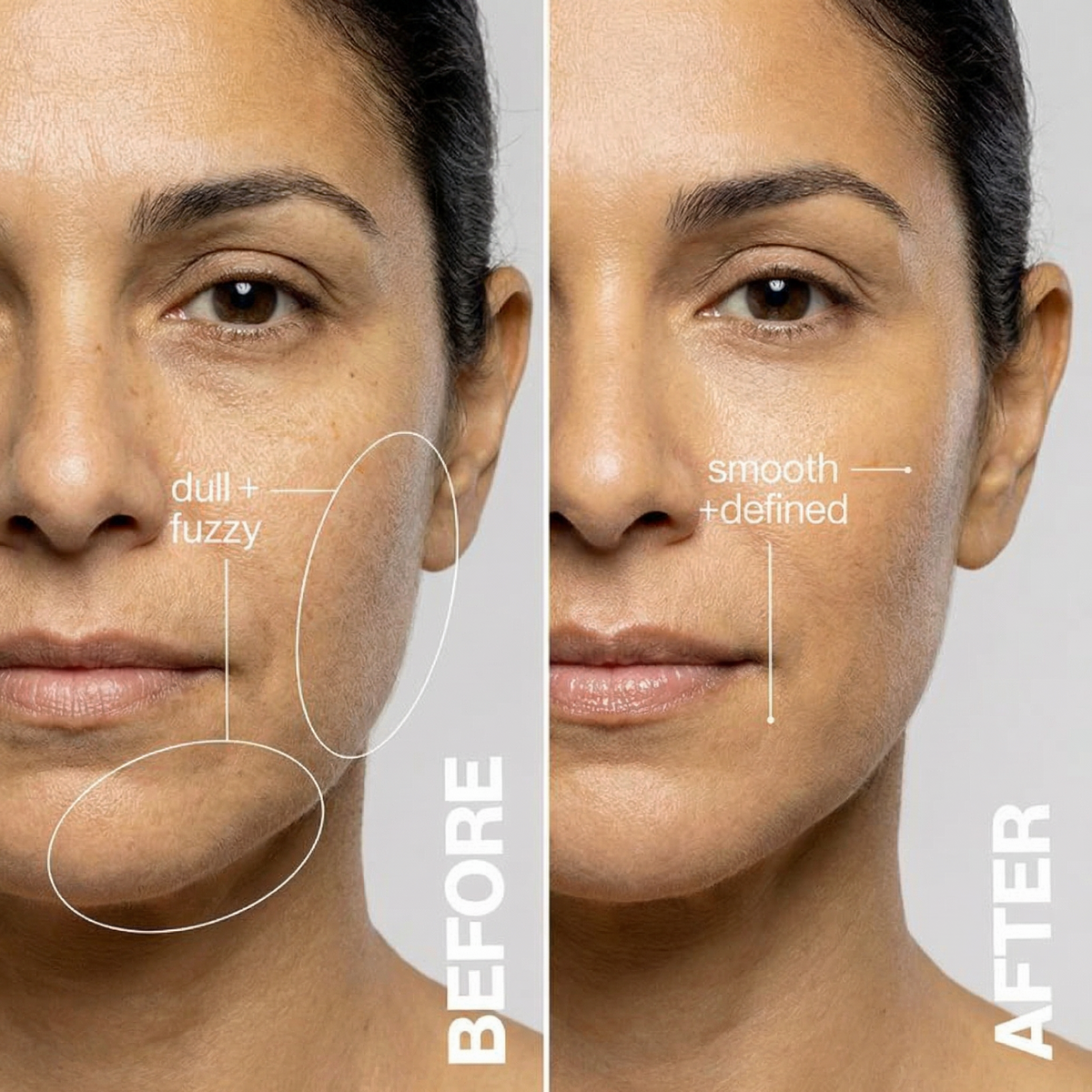 Fresh-Faced + Fuzz-Free